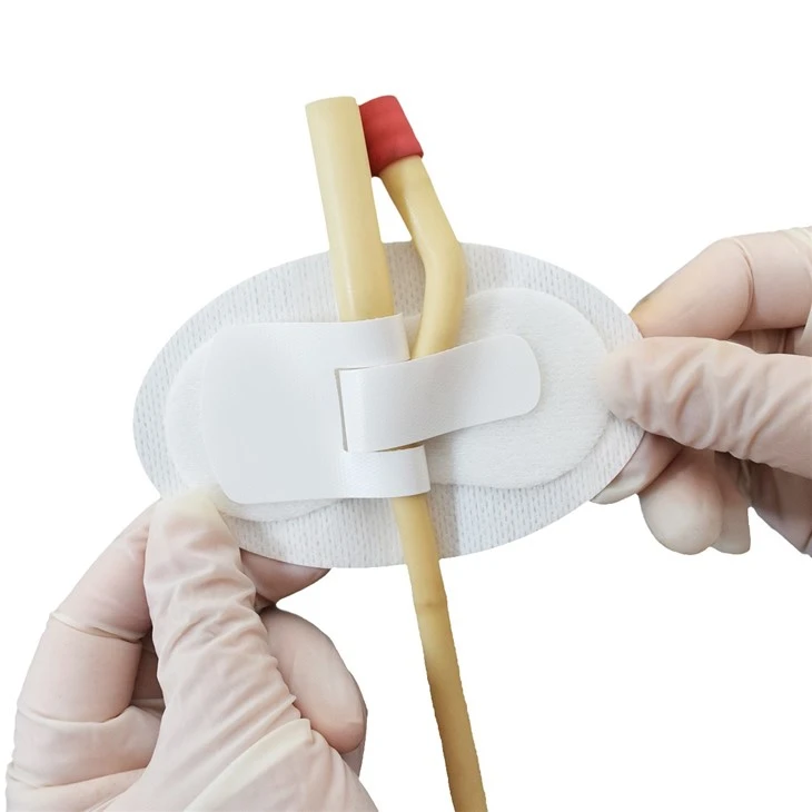 C0611 Type Urethral Catheter Fixation Device